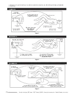 Предварительный просмотр 76 страницы Cooper Surgical LEEP System 1000 Operating Manual