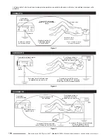 Предварительный просмотр 140 страницы Cooper Surgical LEEP System 1000 Operating Manual