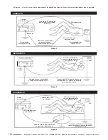 Предварительный просмотр 172 страницы Cooper Surgical LEEP System 1000 Operating Manual