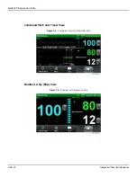 Предварительный просмотр 14 страницы Covidien Nellcor GR101704-RR Operator'S Manual