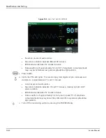 Preview for 152 page of Covidien Nellcor GR101704 Service Manual