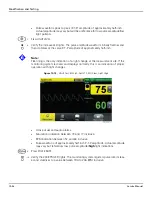 Preview for 158 page of Covidien Nellcor GR101704 Service Manual