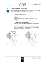 Preview for 35 page of CSO A900 Instructions For Use Manual