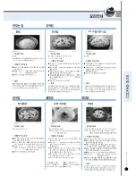 Preview for 41 page of Cuckoo CRP-JH10 Fuzzy Series Operating Instructions Manual