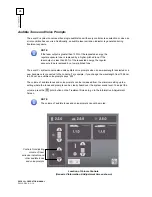 Preview for 34 page of Cutera Excel V+ Operator'S Manual