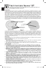 Preview for 4 page of Davol BARD VENTRIO ST Instructions For Use Manual