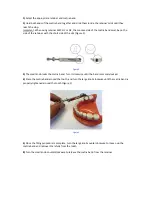 Предварительный просмотр 2 страницы Dentatus Nyström Instruction Manual