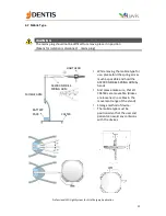 Предварительный просмотр 25 страницы DENTIS LUVIS L200 User Manual