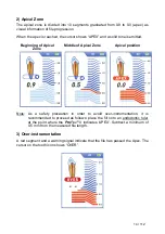 Preview for 14 page of Dentsply Maillefer PROPEX II User Manual