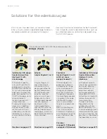 Preview for 16 page of Dentsply Sirona Ankylos Balance Base Abutment C Laboratory Manual