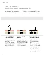 Preview for 18 page of Dentsply Sirona Ankylos Balance Base Abutment C Laboratory Manual