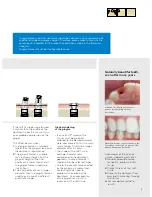 Preview for 19 page of Dentsply Sirona Ankylos Balance Base Abutment C Laboratory Manual