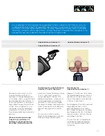 Preview for 25 page of Dentsply Sirona Ankylos Balance Base Abutment C Laboratory Manual