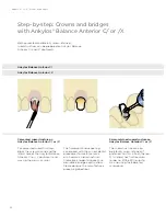 Preview for 26 page of Dentsply Sirona Ankylos Balance Base Abutment C Laboratory Manual