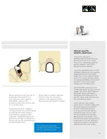 Preview for 27 page of Dentsply Sirona Ankylos Balance Base Abutment C Laboratory Manual