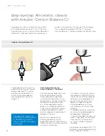 Preview for 28 page of Dentsply Sirona Ankylos Balance Base Abutment C Laboratory Manual