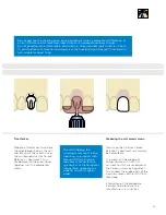 Preview for 29 page of Dentsply Sirona Ankylos Balance Base Abutment C Laboratory Manual