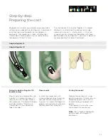 Preview for 35 page of Dentsply Sirona Ankylos Balance Base Abutment C Laboratory Manual