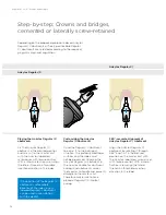 Preview for 36 page of Dentsply Sirona Ankylos Balance Base Abutment C Laboratory Manual