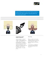 Preview for 37 page of Dentsply Sirona Ankylos Balance Base Abutment C Laboratory Manual