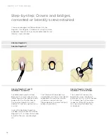 Preview for 38 page of Dentsply Sirona Ankylos Balance Base Abutment C Laboratory Manual