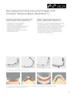 Preview for 43 page of Dentsply Sirona Ankylos Balance Base Abutment C Laboratory Manual