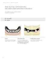 Preview for 52 page of Dentsply Sirona Ankylos Balance Base Abutment C Laboratory Manual