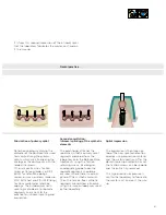 Preview for 61 page of Dentsply Sirona Ankylos Balance Base Abutment C Laboratory Manual