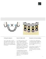 Preview for 77 page of Dentsply Sirona Ankylos Balance Base Abutment C Laboratory Manual