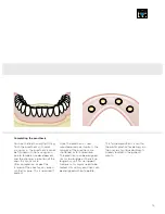 Preview for 79 page of Dentsply Sirona Ankylos Balance Base Abutment C Laboratory Manual