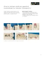 Preview for 85 page of Dentsply Sirona Ankylos Balance Base Abutment C Laboratory Manual