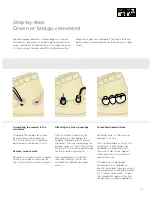 Preview for 93 page of Dentsply Sirona Ankylos Balance Base Abutment C Laboratory Manual