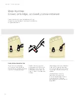 Preview for 94 page of Dentsply Sirona Ankylos Balance Base Abutment C Laboratory Manual