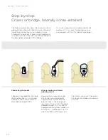 Preview for 96 page of Dentsply Sirona Ankylos Balance Base Abutment C Laboratory Manual