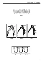 Preview for 3 page of DENTSPLY Biodent K+B Plus Instructions For Use Manual