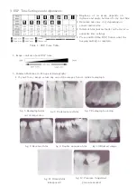 Предварительный просмотр 2 страницы Dexcowin iRay D3 Quick Start Instructions