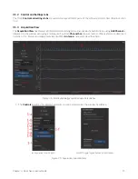 Preview for 15 page of DORIC Fiberless and Wireless Optogenetically Synchronized Electrophysiology System User Manual