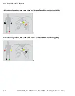 Предварительный просмотр 210 страницы Dräger Infinity Acute Care System M540 Instructions For Use Manual