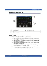 Preview for 29 page of Dräger Infinity Vista Instructions For Use Manual