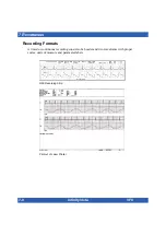 Preview for 122 page of Dräger Infinity Vista Instructions For Use Manual