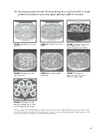 Preview for 7 page of DrBrowns Deluxe Bottle Sterilizer User Instructions