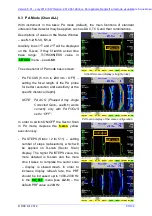 Preview for 83 page of DRC D 1000LF Operation Manual