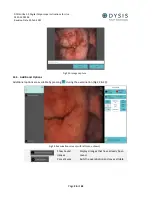 Preview for 26 page of DYSIS DYS403 Instructions For Use Manual