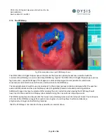 Preview for 31 page of DYSIS DYS403 Instructions For Use Manual