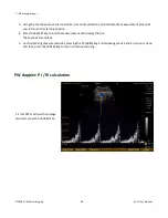 Preview for 84 page of E. I. Medical Imaging Ibex EVO User Manual