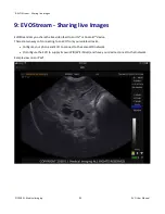 Preview for 92 page of E. I. Medical Imaging Ibex EVO User Manual