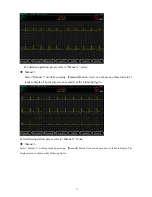 Предварительный просмотр 35 страницы ECGMAC EM-1201 Manual