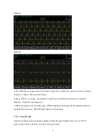 Preview for 37 page of ECGMAC EM-1203 Manual