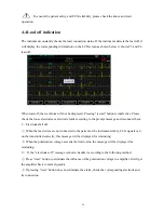 Preview for 27 page of ECGMAC EM-301 User Manual