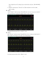 Preview for 34 page of ECGMAC EM-301 User Manual